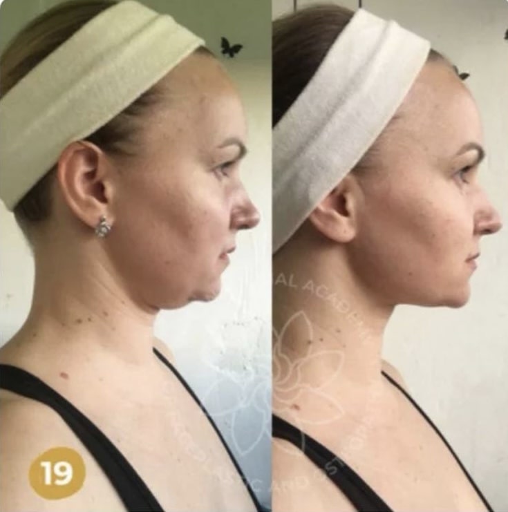 Results after training :: FACEPLASTIC AND OSTEOPATHY - FZCO