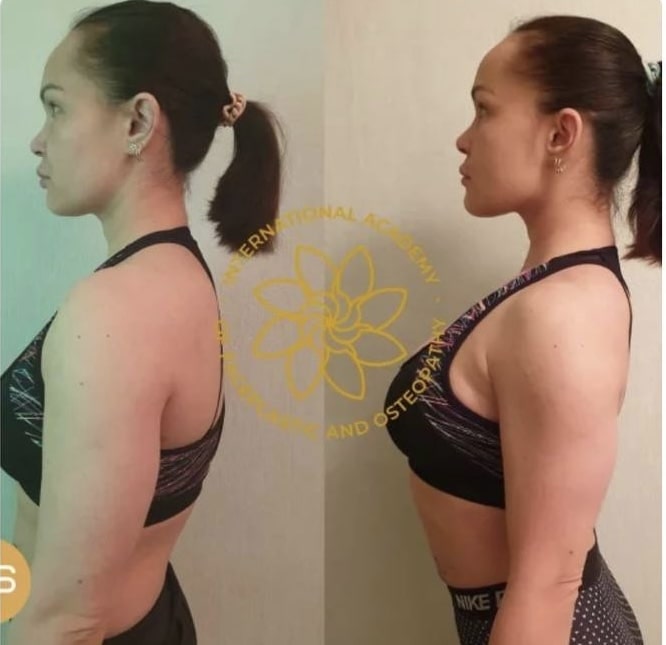 Results after training :: FACEPLASTIC AND OSTEOPATHY - FZCO